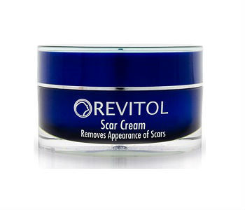 Revitol Scar Cream Review - For Reducing The Appearance Of Scars