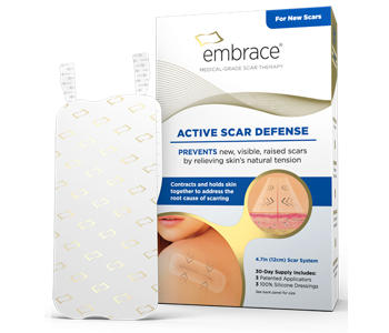 Embrace Active Scar Defense Review - For Reducing The Appearance Of Scars