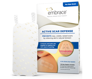 Embrace Active Scar Defense Review Embrace Active Scar Defense Review - For Reducing The Appearance Of Scars