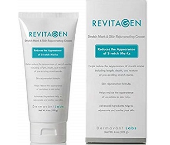 Revitagen Stretch Mark Eraser Review - For Reducing The Appearance Of Stretch Marks